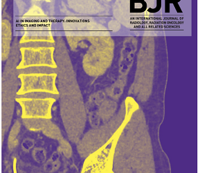 Pearls and pitfalls of structured staging and reporting of rectal cancer on MRI: an international multireader study
